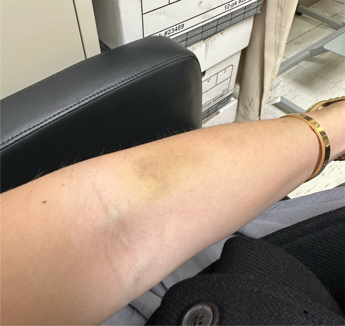 Random bruise that wouldn't heal for months.