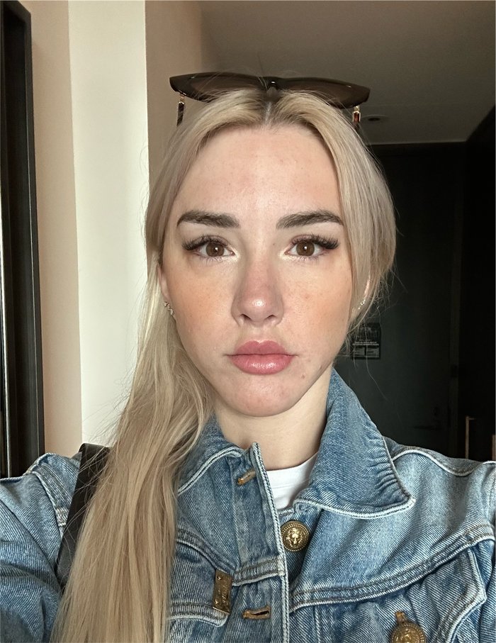 Mikhaila's face swollen from mold exposure.